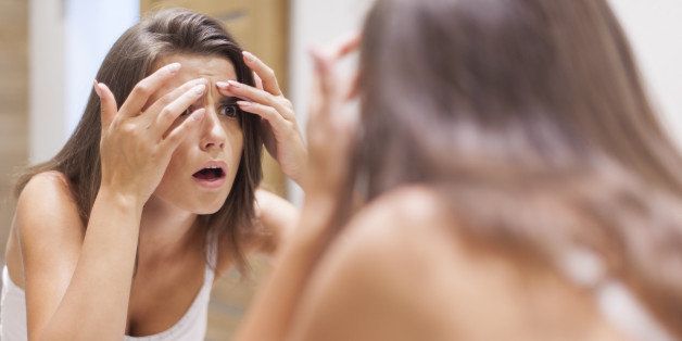 5 Possible Reasons You Have Acne